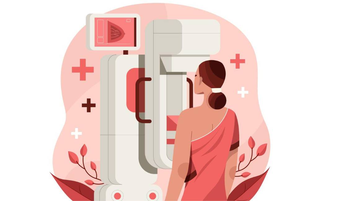 La mastografía permite detectar alteraciones en el tejido mamario antes de que puedan sentirse al tacto, por lo que es importante realizarla según las recomendaciones médicas.
